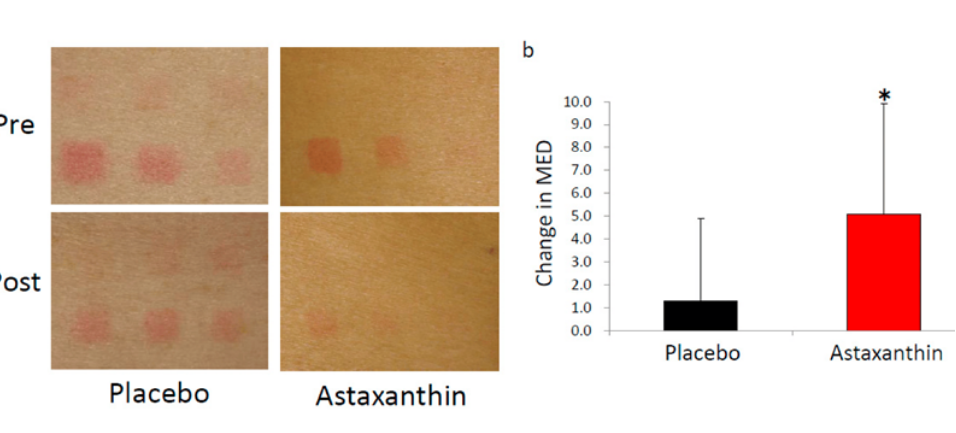 艾詩(shī)特蝦青素 艾詩(shī)特蝦青素