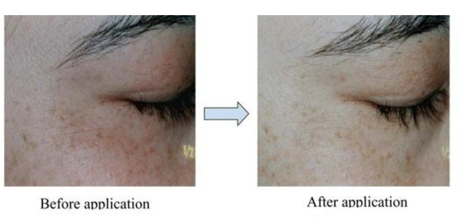 艾詩(shī)特蝦青素 艾詩(shī)特蝦青素