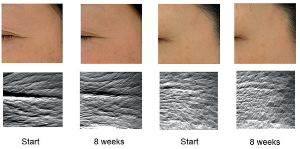 艾詩(shī)特蝦青素 艾詩(shī)特蝦青素