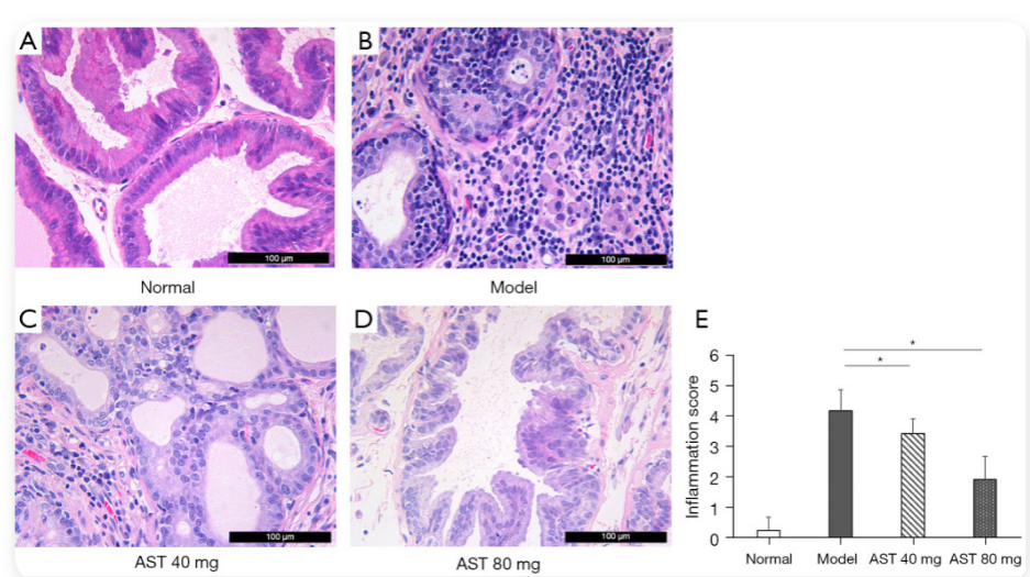 艾詩(shī)特蝦青素 艾詩(shī)特蝦青素