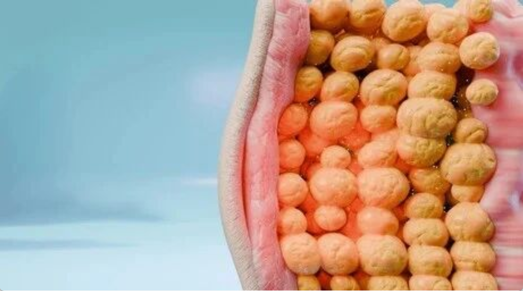 艾詩(shī)特蝦青素 艾詩(shī)特蝦青素