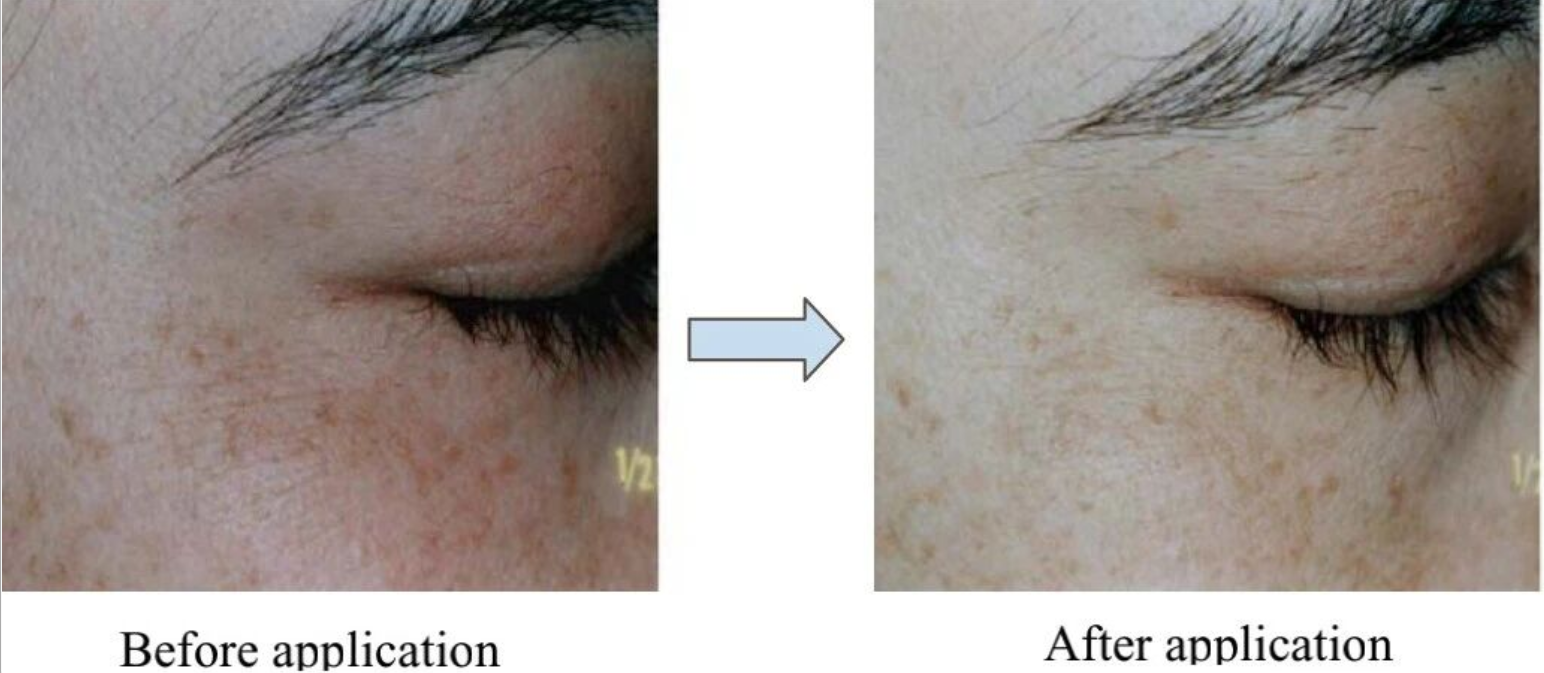 艾詩特蝦青素 艾詩特蝦青素