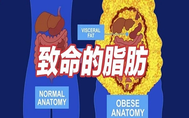 這種致命的脂肪，你可能正在瘋狂囤積！1分鐘自測!